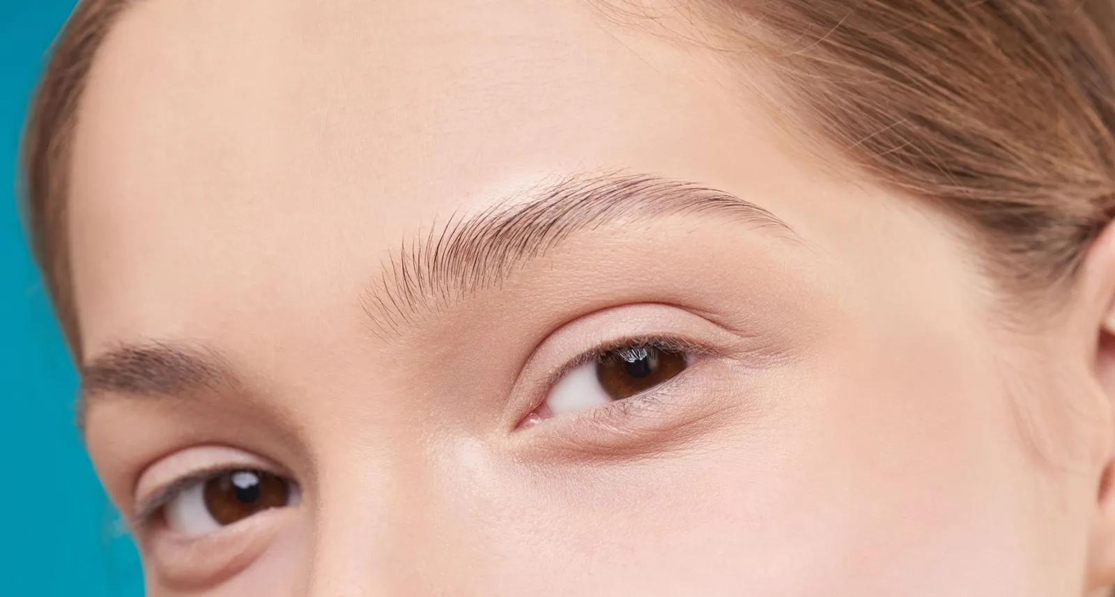 Brow Lift